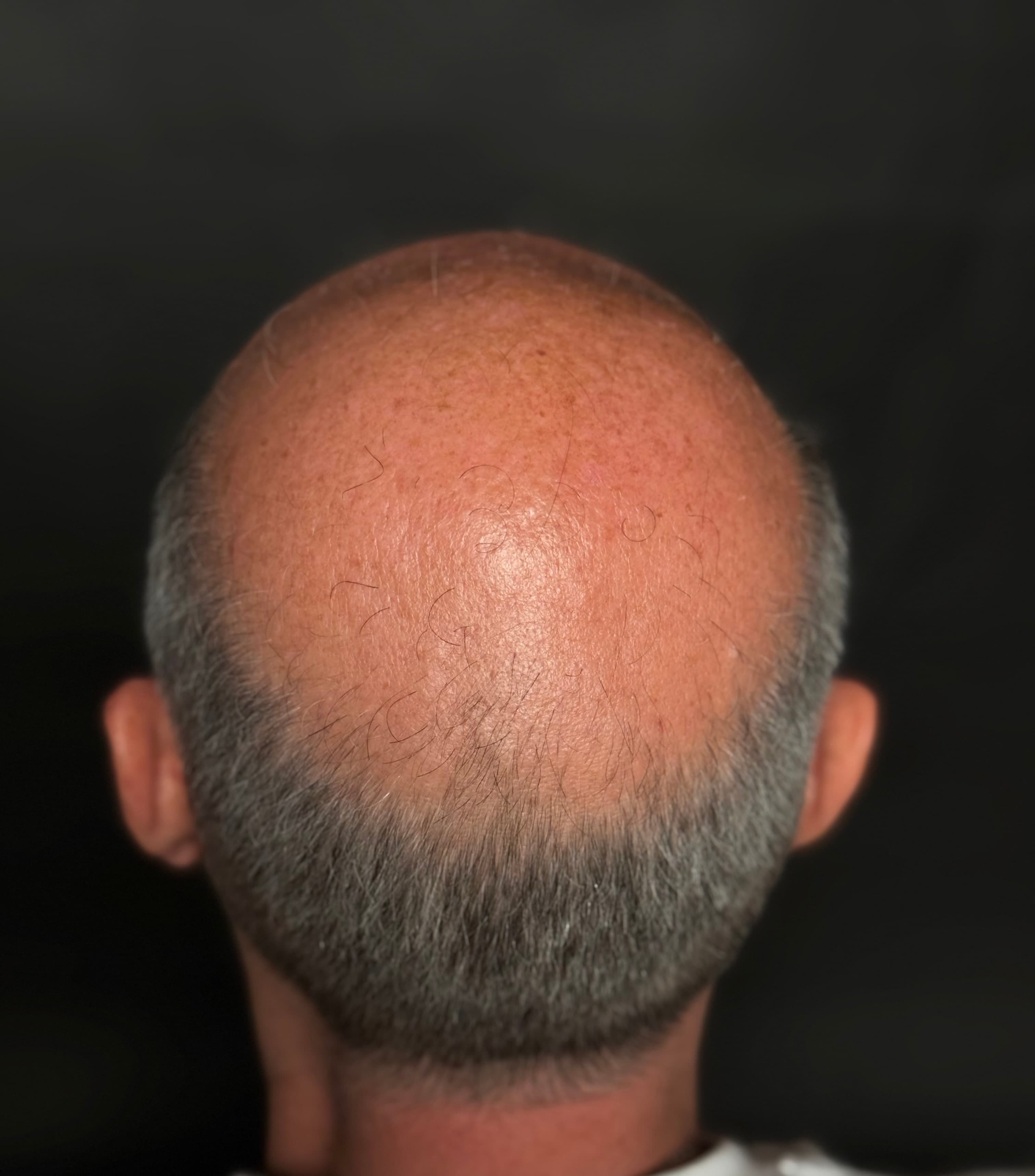 Πριν την εφαρμογή SMP